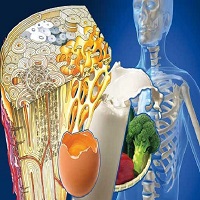 سالم ترین راه برای پیشگیری از پوکی استخوان
